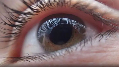 Ölümcül hastalığa yakalanmış olabilirsiniz. Gözleriniz şiş şekilde uyanıyorsanız dikkat