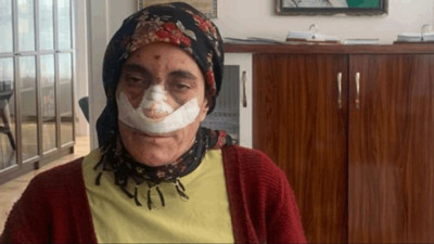 İmam yardım parasını soran kadını sopayla dövdü. Küfürler savurdu