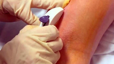 3 yıl boyunca konforlu cinsel korunma tedavisi belli oldu