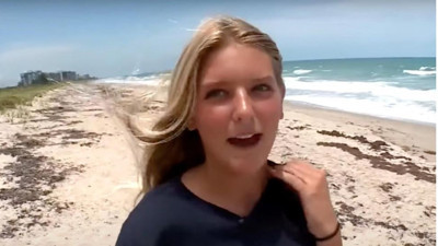 Köpekbalığı 13 yaşındaki kızı kanlar içinde bıraktı