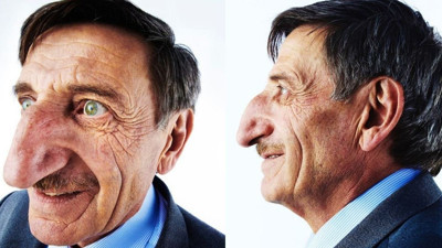 Dünyanın en uzun burunlu insanı Artvinli Mehmet öldü