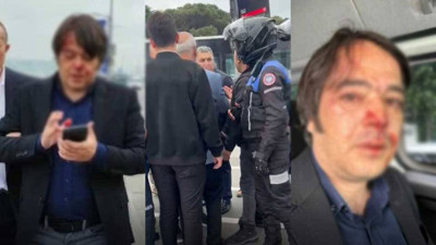 Üsküdar’da kaçak kafe yıkımı sırasında arbede çıktı. İBB İmar Müdürü kafe sahipleri tarafından darp edildi