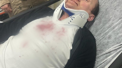 Kırmızı ışıkta aracının içinde yumruklu saldırıya uğradı