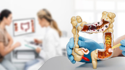 Uzmanından bağırsak sorunlarıyla ilgili kritik açıklama