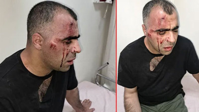 Gazeteci Sinan Aygül'e saldırı. "Belediye başkanının korumalarının saldırısına uğradım"