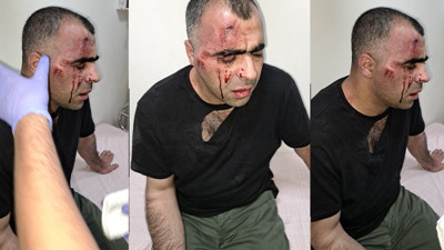 AKP’li belediyedeki usulsüzlük iddialarını gündeme getirdiği için silahlı saldırıya uğramıştı. Gazeteci Sinan Aygül'ü darp eden korumalar açığa alındı