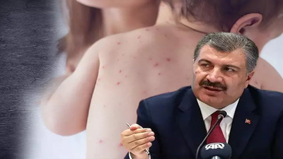 Bakan Koca’dan kızamık açıklaması