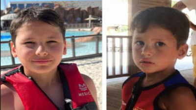 Çağla Şıkel'den 'öncesi-sonrası' paylaşımı