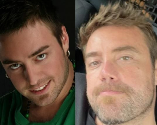 Ünlü şarkıcı Murat Dalkılıç'ın son hali hayranlarını endişelendirdi! 12. kez bıçak altına mı yattı? - Resim: 26