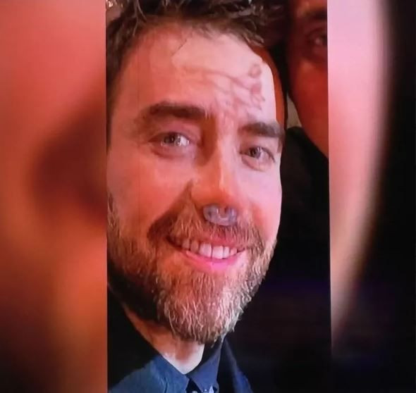 Ünlü şarkıcı Murat Dalkılıç'ın son hali hayranlarını endişelendirdi! 12. kez bıçak altına mı yattı? - Resim: 20