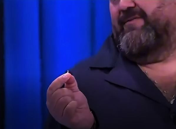 MasterChef'te mide bulandıran anlar: Somer Şef tabakta tırnak buldu! - Resim: 12