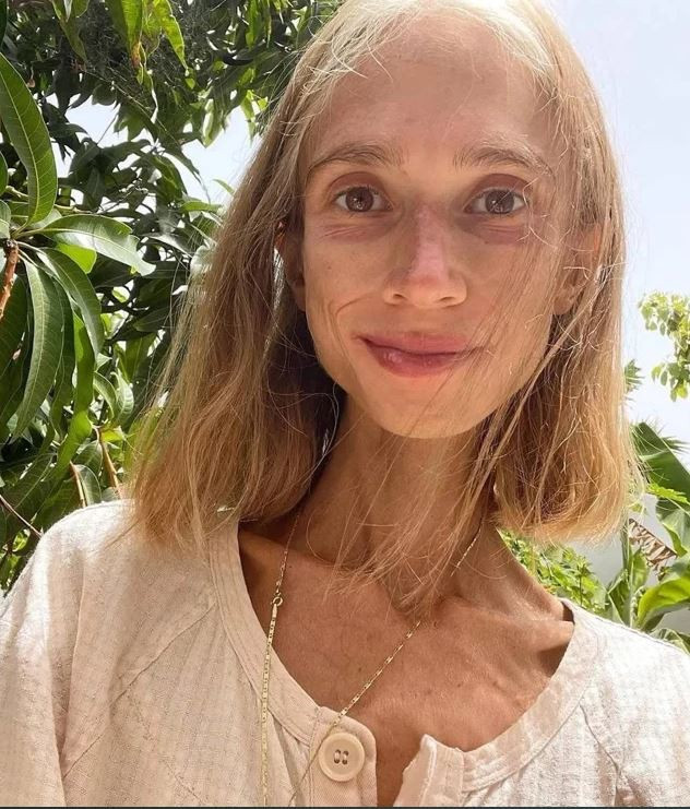 Uyguladığı akım sonu oldu! Sosyal medya fenomeninin cansız bedenini görevliler buldu - Resim : 2