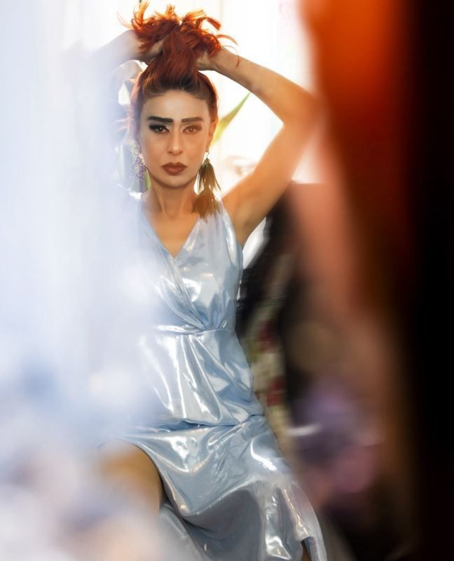 Yıldız Tilbe'yi örümcek ısırdı! Aksilikler kraliçesi... Yüzü korkuttu - Resim: 6