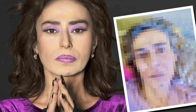 Yıldız Tilbe'yi örümcek ısırdı! Aksilikler kraliçesi... Yüzü korkuttu