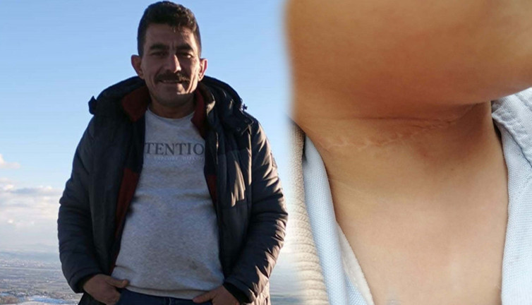 1,5 yaşındaki çocuğun boynunu kesen sanığın cezası belli oldu