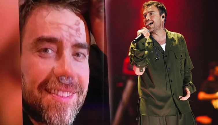 Ünlü şarkıcı Murat Dalkılıç'ın son hali hayranlarını endişelendirdi! 12. kez bıçak altına mı yattı?