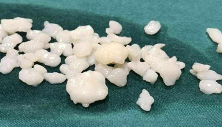 Minicikler çok can acıtıyorlar