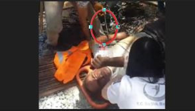 Hastaneye saplanan demirle kaldırıldı