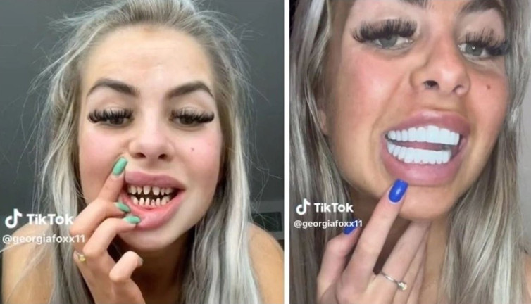 İngiliz fenomen Georgia Fox dişlerini paylaştı: Türkiye'yi öve öve bitiremedi