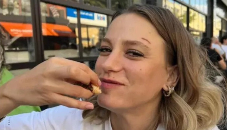 Serenay Sarıkaya’nın kaşındaki yara izinin nedeni belli oldu. Gerçek bambaşka çıktı