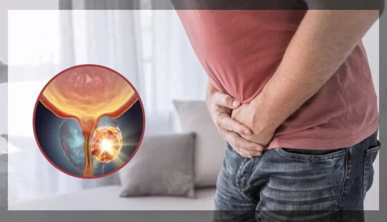 Prostat kanserinde hayat kurtaran 4 öneri