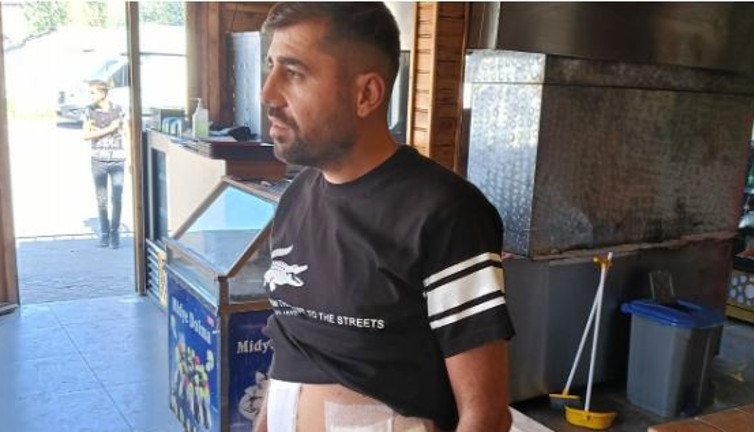 Kadına laf atanları uyardı vücuduna 30 dikiş atıldı