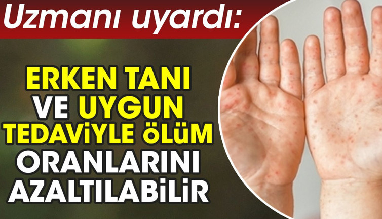 Uzmanı uyardı: Erken tanı ve uygun tedaviyle ölüm oranlarının azaltılabilir