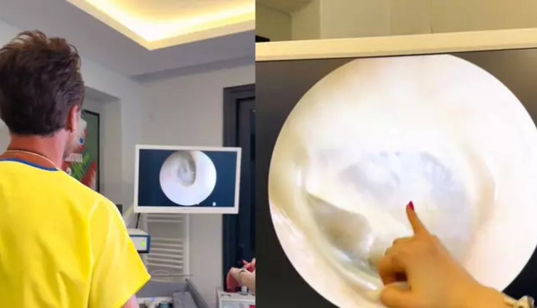 Eşini öperken kulağının zarını patlattı. Sevginin de çoğu zarar