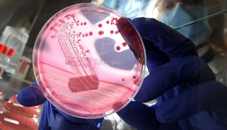 Uluslararası yumurtalık kanseri uygulaması Türkçe olacak