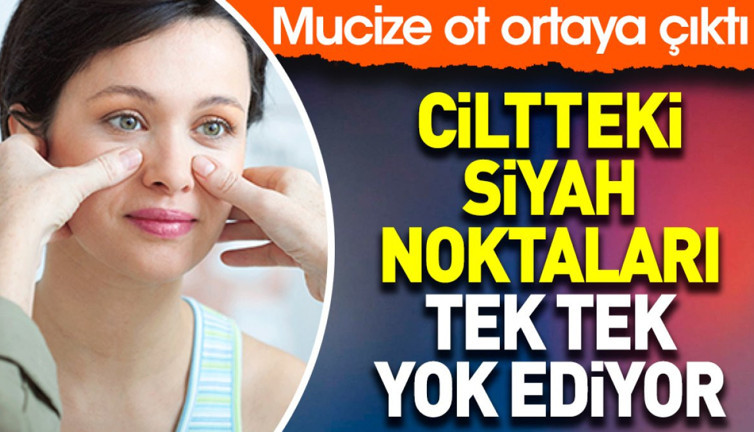 Ciltteki siyah noktaları tek tek yok ediyor. Mucize ot ortaya çıktı