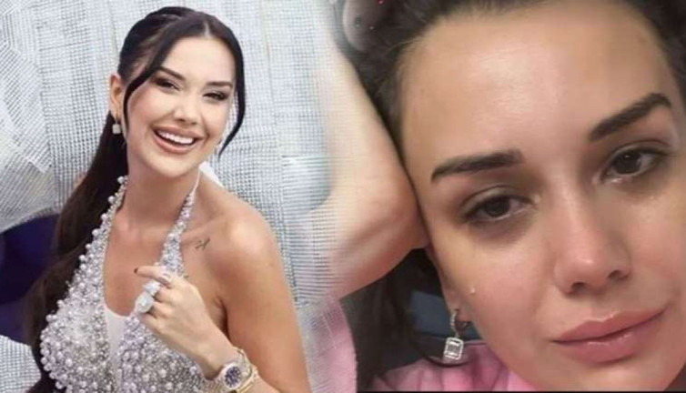 Dilan Polat’ın kelebek hastalığı nedir? Lupus kelebek hastalığı belirtileri neler?