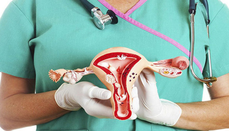 Polikistik Over nasıl tedavi edilir