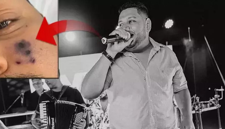 Örümcek ısırığı sonu oldu. Ünlü müzisyenin hayranları ve sevenleri şoke oldu