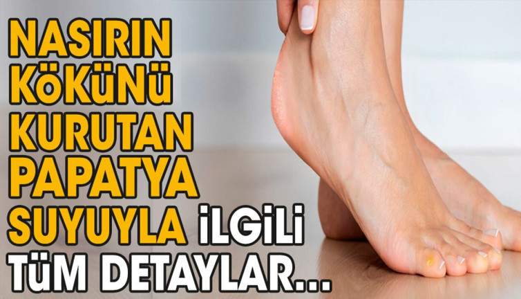 Nasırın kökünü kurutan papatya suyuyla ilgili tüm detaylar…