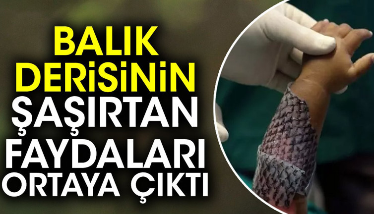 Balık derisinin şaşırtan faydaları ortaya çıktı