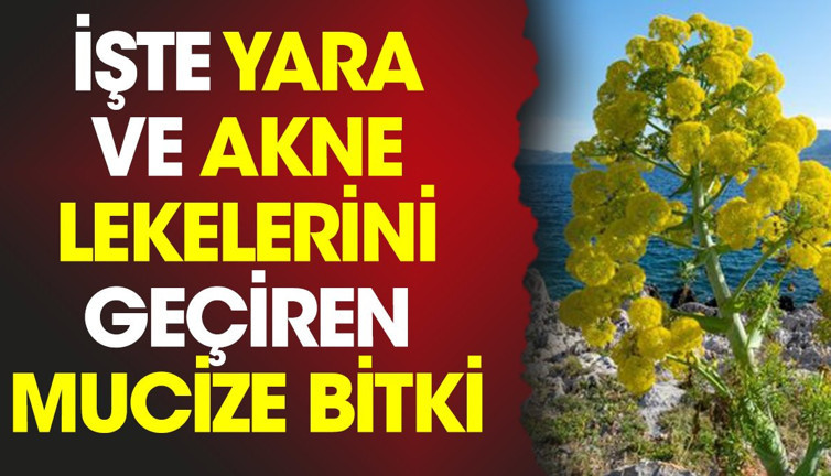 İşte yara ve akne lekelerini geçiren mucize bitki