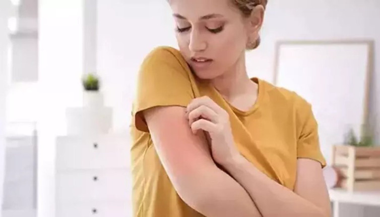 Uyuz hastalığından korunmak için dikkat edilmesi gerekenler. Uzman isim tek tek sıraladı