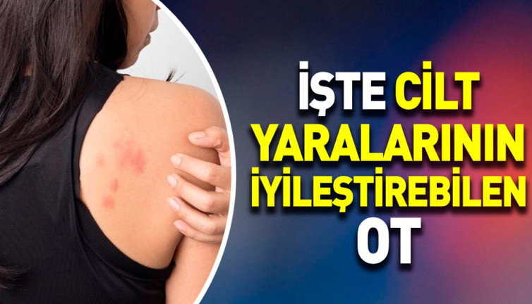 İşte cilt yaralarının iyileştirebilen ot