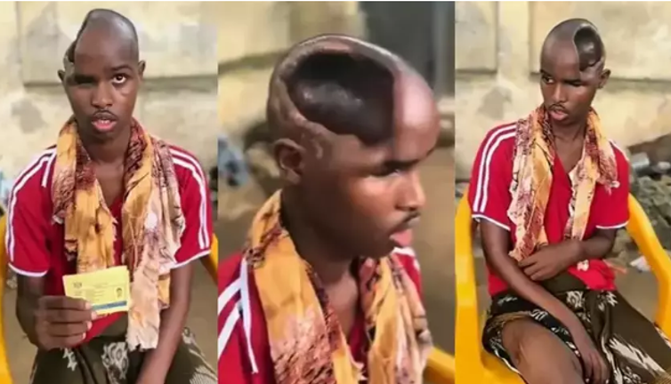 Beyni olmayan adam görenleri şoke etti. ‘Gizli yetenekleri ortaya çıkabilir’