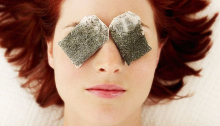 Göz altı torbaları ve mor halkalar neden oluşur? Tedavisi nasıl olur? Nasıl geçer?