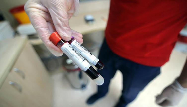 Kan testinden insanların hangi hızda yaşlandığı çıktı. Bilim insanları açıkladı