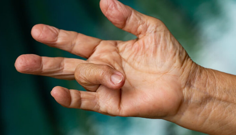 Özellikle kadınların parmağı bir anda böyle kalırsa ne olur