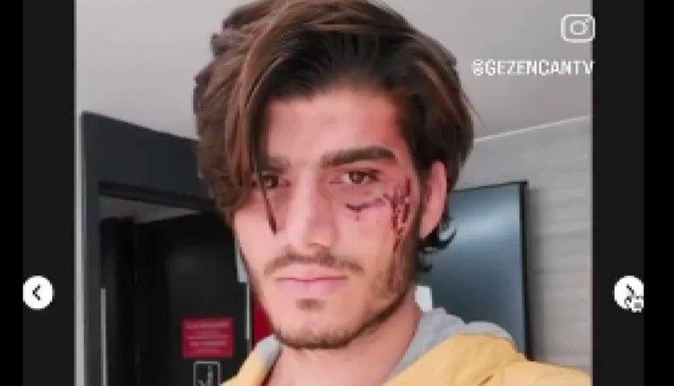 Bir Türk, Sırbistan'da Suriyeliler tarafından gasp edildikten sonra Sırp polislerden şiddet gördüğünü anlattı