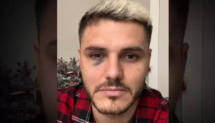 Galatasaray bu fotoğrafla 'Utanın' dedi. Fenerbahçe 'Kale direği' cevabını verdi