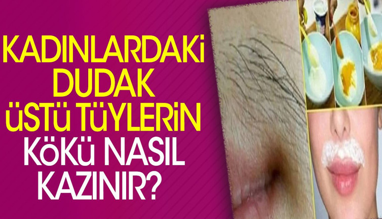 Kadınlardaki dudak üstü tüylerin kökü nasıl kazınır? İşte doğal çözümler…