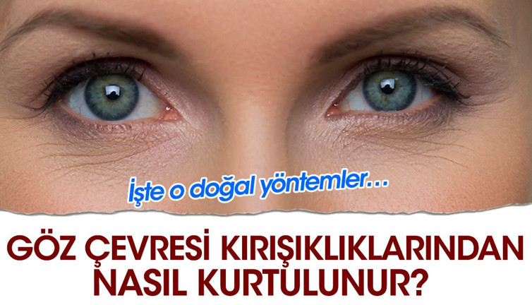 Göz çevresi kırışıklıklarından nasıl kurtulunur? İşte o doğal yöntemler…