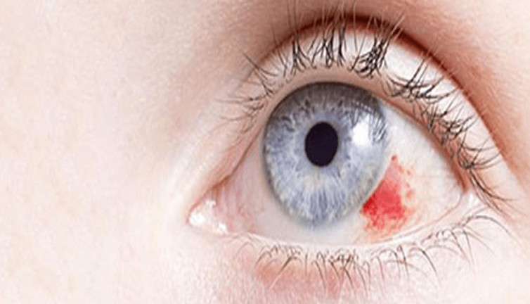 Sinsice belirti vermeden geliyor kör bırakıyor