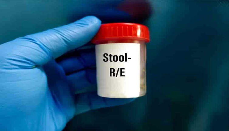 Gizli kan testi sonuçları yanıltabilir mi