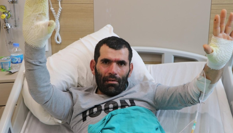 Çocuklarına yemek pişirirken sobaya düştü