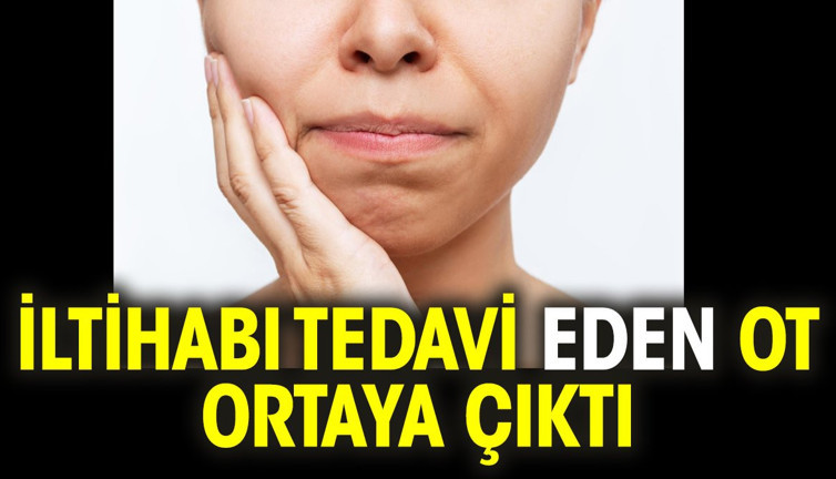 İltihabı tedavi eden ot ortaya çıktı